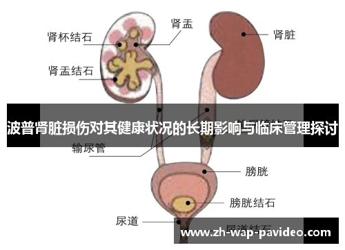 波普肾脏损伤对其健康状况的长期影响与临床管理探讨 波普肾脏损伤对其健康状况的长期影响与临床管理探讨
